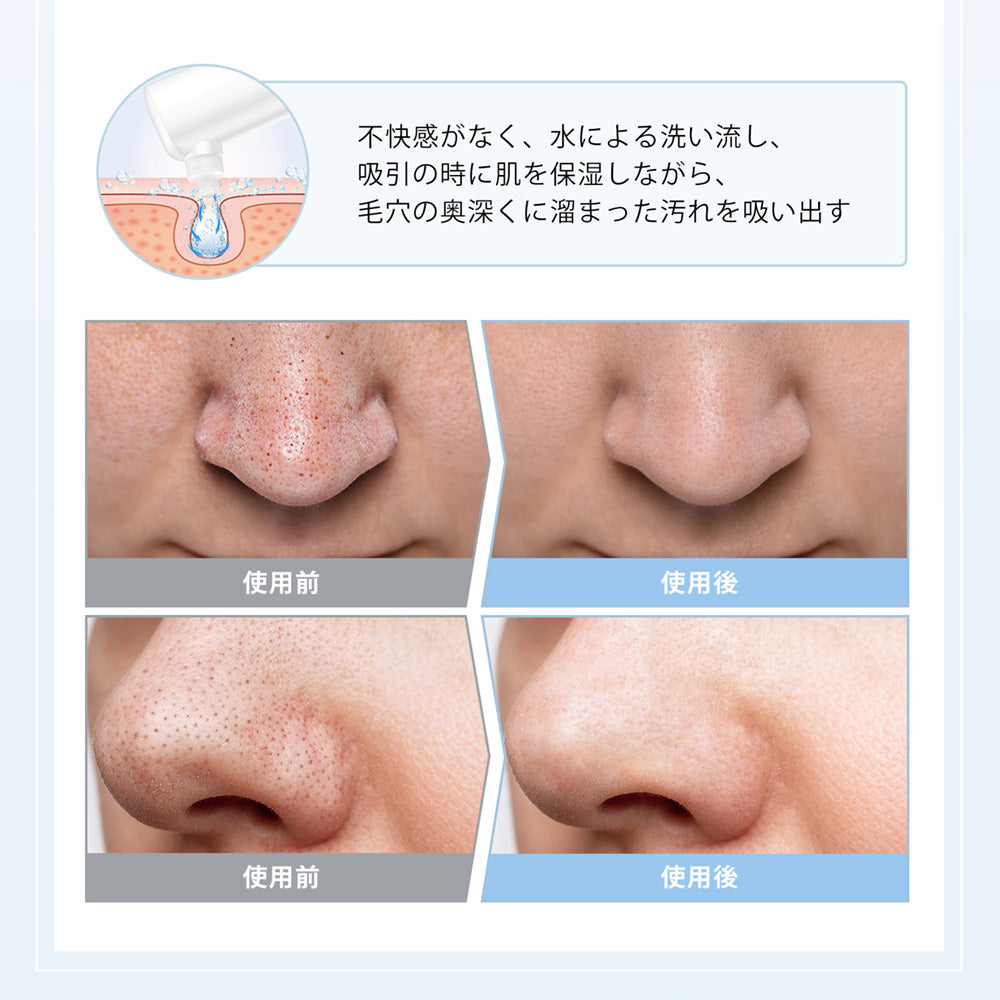 毛穴吸引器 水流式 2025最新版