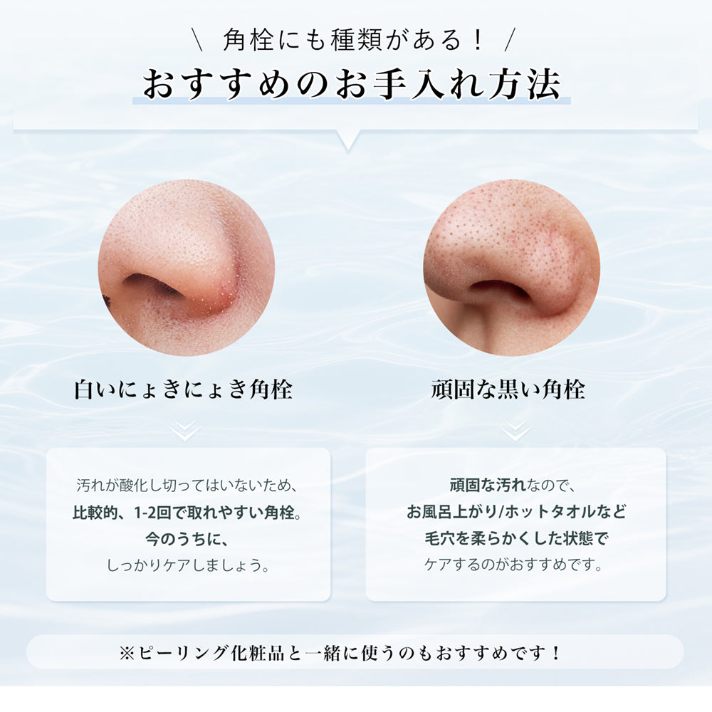 【2025最新版】ANLAN 毛穴吸引器