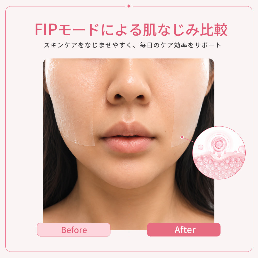 ANLAN Rose Lumi美顔器｜業内初のピンクの光技術 リフトアップ×RF