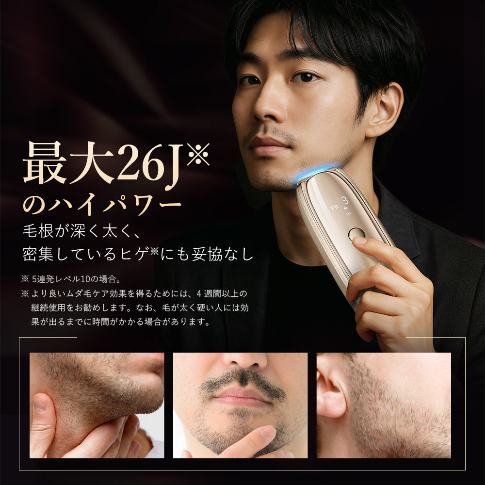 【モニター応募中！】脱毛器Zap 型番T75S