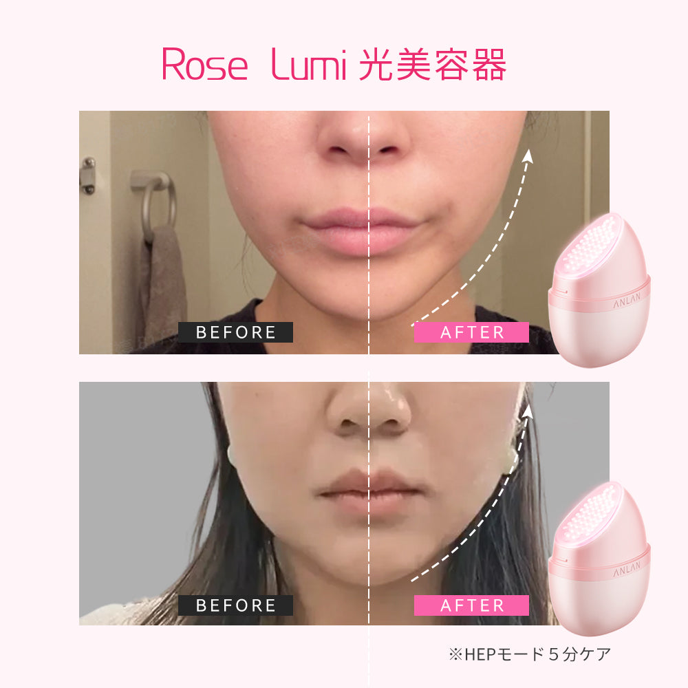 ANLAN Rose Lumi美顔器｜毎日5分のピンクの光美容ケア｜