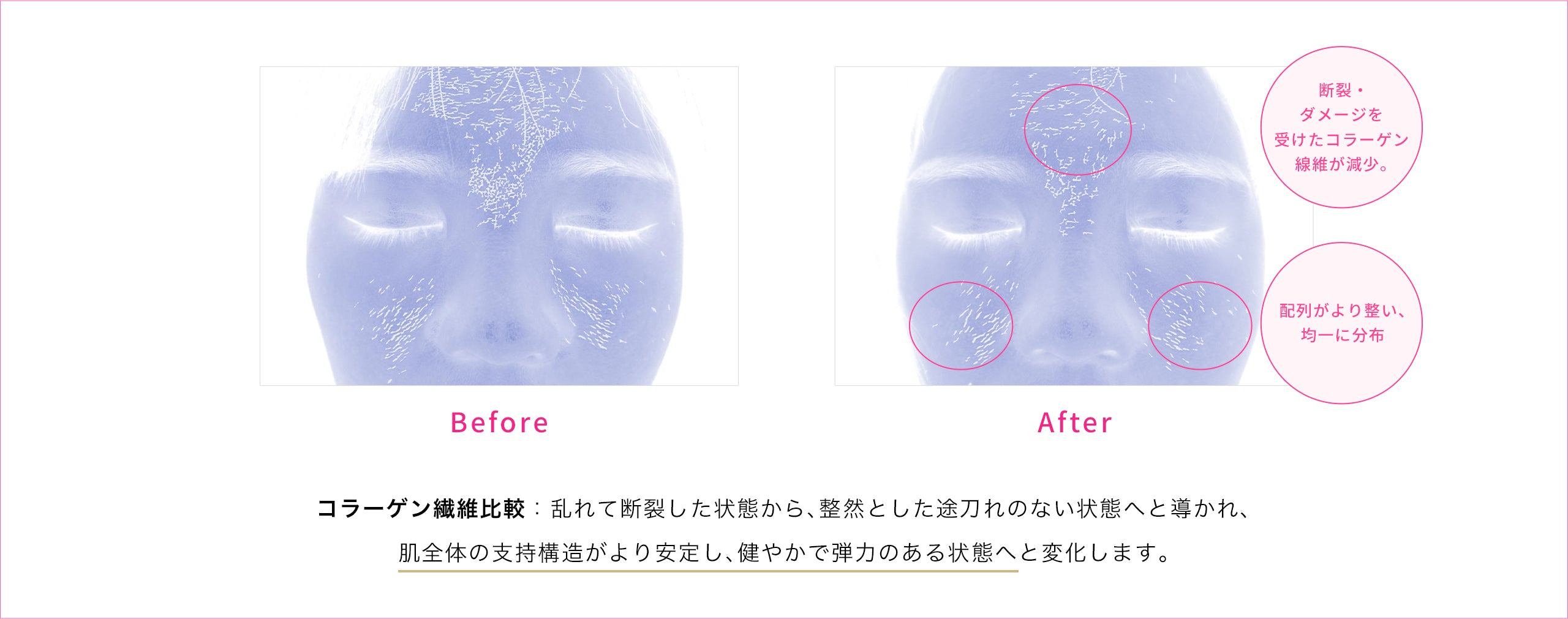 コラーゲン比較 Before After